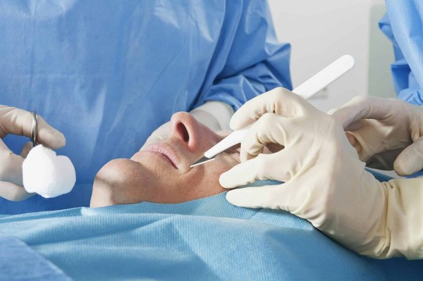 Meilleur chirurgien de l'épaule à Bordeaux : comment faire le bon choix ?